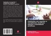 Implantes em maxilas e mandíbulas atróficas maxila e mandíbula atróficas Implantes em maxilas e mandíbulas atróficas maxila e mandíbula atróficas