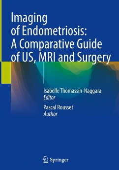 Cover Imaging of Endometriosis: A Comparative Guide of US, MRI and Surgery