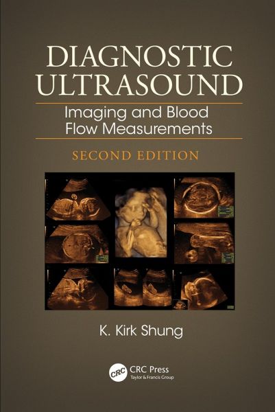 Diagnostic Ultrasound (eBook, ePUB)