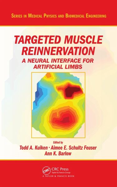 Targeted Muscle Reinnervation (eBook, ePUB)