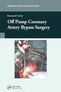 Off-Pump Coronary Artery Bypass Surgery (eBook, ePUB) - Cartier, Raymond