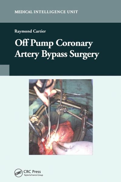 Off-Pump Coronary Artery Bypass Surgery (eBook, ePUB) Off-Pump Coronary Artery Bypass Surgery (eBook, ePUB)