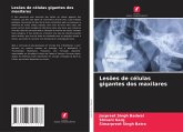 Lesões de células gigantes dos maxilares Lesões de células gigantes dos maxilares