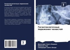 Cover Gigantokletochnye porazheniq chelüstej