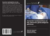 Curación lumboaórtica en los cánceres ginecológicos pélvicos Curación lumboaórtica en los cánceres ginecológicos pélvicos