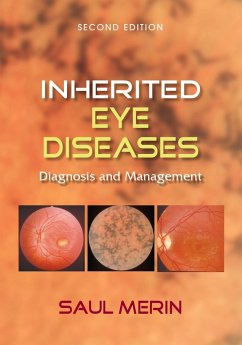 Inherited Eye Diseases (eBook, ePUB) - Merin, Saul