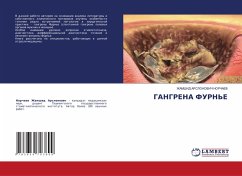 GANGRENA FURN'E - Norchaew, Zhamshid Arslonowich