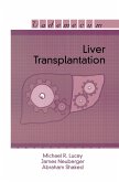 Liver Transplantation (eBook, ePUB)