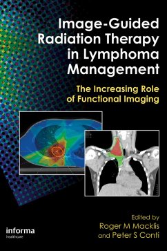 Cover Image-Guided Radiation Therapy in Lymphoma Management (eBook, ePUB)