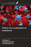 Fibrina rica en plaquetas en endodoncia Fibrina rica en plaquetas en endodoncia