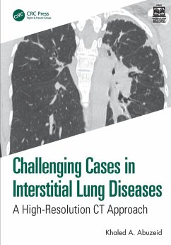 Challenging Cases in Interstitial Lung Diseases - Abuzeid, Khaled A.