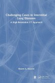 Challenging Cases in Interstitial Lung Diseases Challenging Cases in Interstitial Lung Diseases