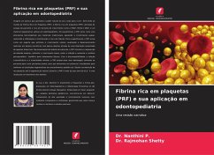 Cover Fibrina rica em plaquetas (PRF) e sua aplicação em odontopediatria