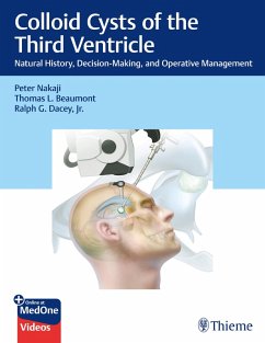 Cover Colloid Cysts of the Third Ventricle (eBook, ePUB)