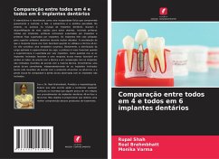 Comparação entre todos em 4 e todos em 6 implantes dentários - Shah, Rupal;BRAHMBHATT, REAL;VARMA, MONIKA