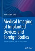 Medical Imaging of Implanted Devices and Foreign Bodies