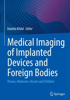 Medical Imaging of Implanted Devices and Foreign Bodies
