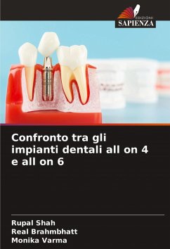 Cover Confronto tra gli impianti dentali all on 4 e all on 6