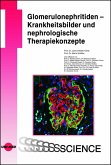 Glomerulonephritiden - Krankheitsbilder und nephrologische Therapiekonzepte (eBook, PDF) Glomerulonephritiden - Krankheitsbilder und nephrologische Therapiekonzepte (eBook, PDF)