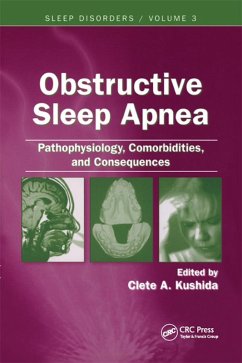 Obstructive Sleep Apnea (eBook, ePUB) - Kushida, Clete A.