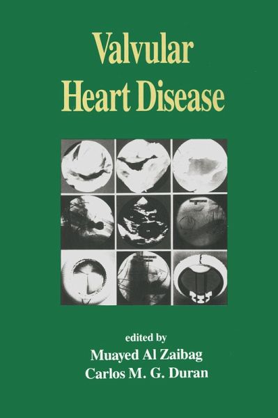 Valvular Heart Disease (eBook, ePUB) Valvular Heart Disease (eBook, ePUB)