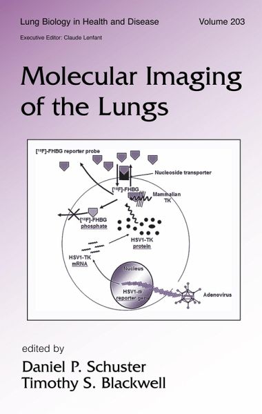 Molecular Imaging of the Lungs (eBook, ePUB)