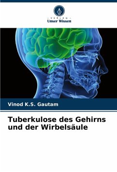 Cover Tuberkulose des Gehirns und der Wirbelsäule