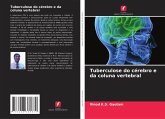 Tuberculose do cérebro e da coluna vertebral