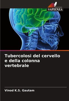 Cover Tubercolosi del cervello e della colonna vertebrale