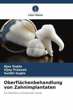 Oberflächenbehandlung von Zahnimplantaten - Gupta, Ajay;Prakash, Vijay;Gupta, Surbhi