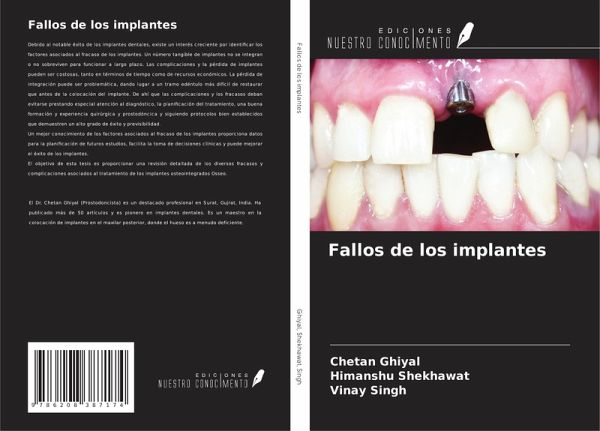 Fallos de los implantes