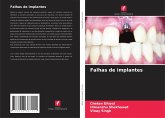 Falhas de implantes