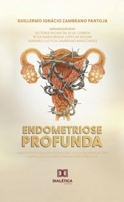 Endometriose Profunda (eBook, ePUB) - Pantoja, Guillermo Ignácio Zambrano; Correia, Victoria Regina da Silva; Moura, Rosa Maria Braga Lopes de; Marcondes, Sandrielli Leticia Zambrano