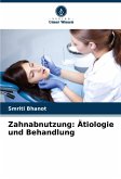 Zahnabnutzung: Ätiologie und Behandlung Zahnabnutzung: Ätiologie und Behandlung