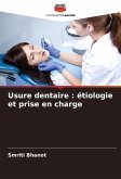 Usure dentaire : étiologie et prise en charge Usure dentaire : étiologie et prise en charge