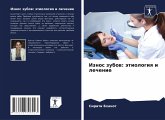 Iznos zubow: ätiologiq i lechenie Iznos zubow: ätiologiq i lechenie