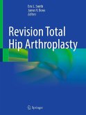 Revision Total Hip Arthroplasty