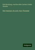 Des tumeurs du sein chez l'homme Des tumeurs du sein chez l'homme