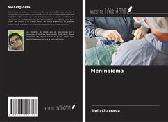 Meningioma - Chaurasia, Bipin Meningioma - Chaurasia, Bipin