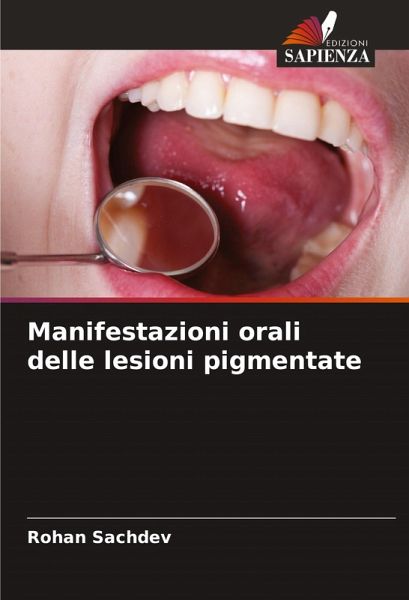 Manifestazioni orali delle lesioni pigmentate