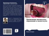 Proqwleniq pigmentnyh porazhenij w polosti rta Proqwleniq pigmentnyh porazhenij w polosti rta