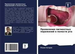 Cover Proqwleniq pigmentnyh porazhenij w polosti rta