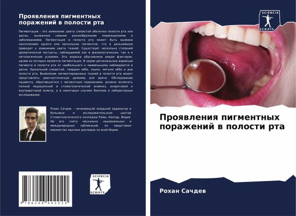 Proqwleniq pigmentnyh porazhenij w polosti rta