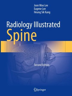 Radiology Illustrated: Spine - Lee, Joon Woo;Lee, Eugene;Kang, Heung Sik