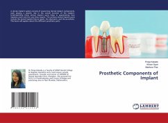 Prosthetic Components of Implant - Kakade, Pooja; Syed, Khizer; Titar, Madhura