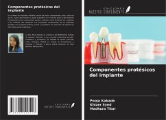 Cover Componentes protésicos del implante