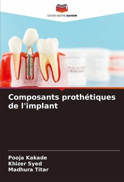 Composants prothétiques de l'implant - Kakade, Pooja;Syed, Khizer;Titar, Madhura