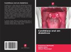 Candidíase oral em diabéticos Candidíase oral em diabéticos