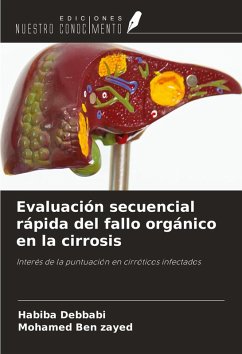 Cover Evaluación secuencial rápida del fallo orgánico en la cirrosis
