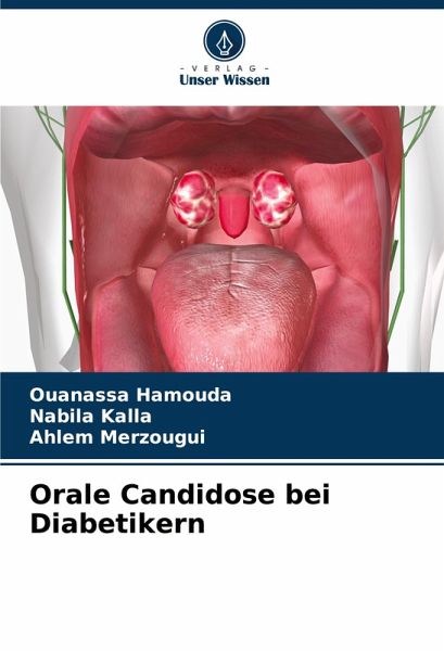 Orale Candidose bei Diabetikern Orale Candidose bei Diabetikern